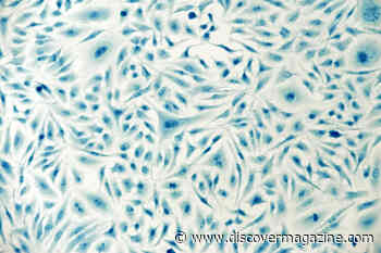 Henrietta Lacks’ Cells Were Taken Without Consent, so How Is Her DNA Protected Today?