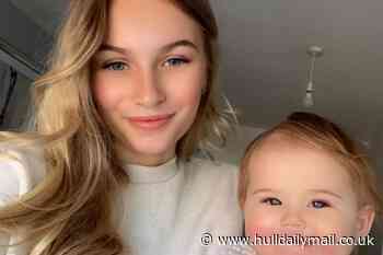 Baby suffered chemical burns to face when celery reacted with sunlight