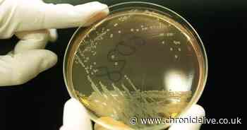 Health experts confirm E.coli outbreak across UK with 113 cases and people admitted to hospital