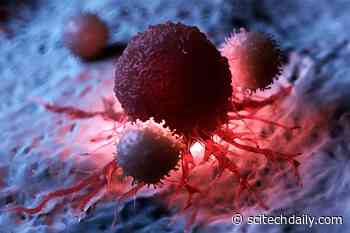 Cancer Breakthrough: Scientists Discover Game-Changing New Type of T Cells