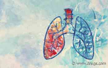 Lung Cancer Screening Increases Earlier-Stage Diagnoses, Improves Survival