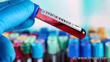 Prevalence of Iron Deficiency Varies With Different Definitions