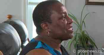 Impending loss of reconstructive surgeon worries Alberta face cancer patient