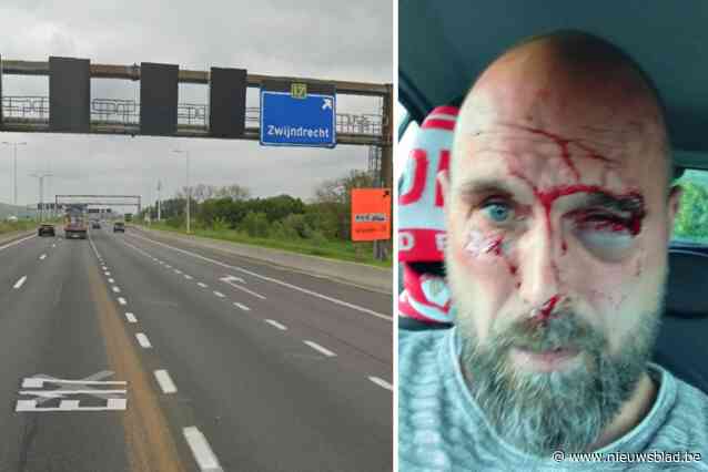Björn (46) klemgereden en in elkaar geslagen op pechstrook E17 in Zwijndrecht: “Ze lieten mij voor dood achter en reden verder”