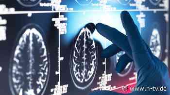 Neue einfache Frühwarnmethode?: Gehirnscan erkennt Demenz Jahre im Voraus