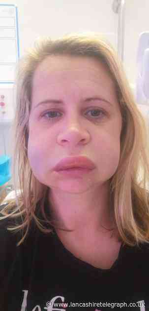 Lancashire woman awarded £14,500 after dental ordeal