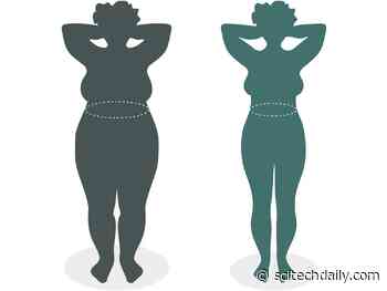 Weight Loss Maintained for 20 Years: Study Reveals Long-Term Effectiveness of Gastric Bypass