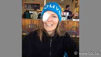 Cancer survivors demand clarity on future of Edmonton facial reconstruction clinic