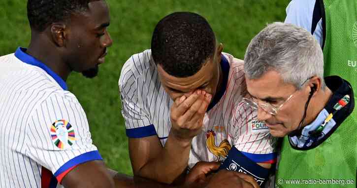 Mbappé mit Nasenbeinbruch – vorerst keine Operation
