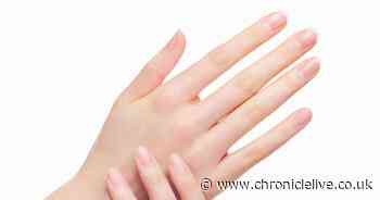 Three signs in your hands that could mean you have serious health issues including cancer