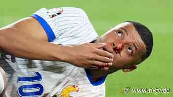 "Zeitpunkt noch offen": Mbappé braucht OP für gebrochene Nase