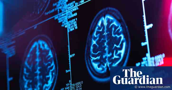 Second Canadian scientist alleges brain illness investigation was shut down
