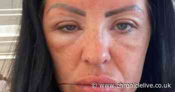 Mum's warning after face swelled up during Lanzarote holiday