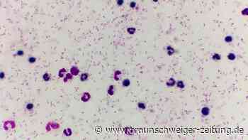 So überzog die tödlichste Krankheit der Geschichte die Welt