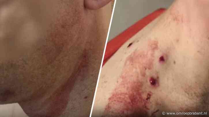 Stel wordt thuis ernstig mishandeld: 'Zag hem liggen in grote plas bloed'