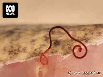 This parasite found across three states can burrow through the skin of fish and, in rare cases, humans