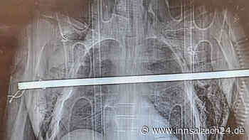 Beim Kirschenpflücken von Leiter gestürzt: Mann (59) spießt sich an Eisenstange auf