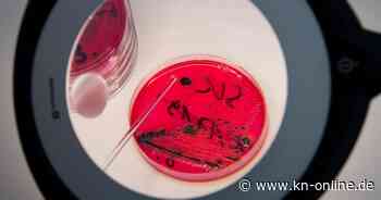 Salmonellengefahr: Importeur ruft Rewe-Wurtst „Salame Felino“ zurück