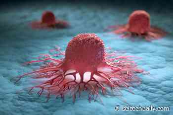 Mystery Solved: Surprising Origins for a Rare Cancer Uncovered