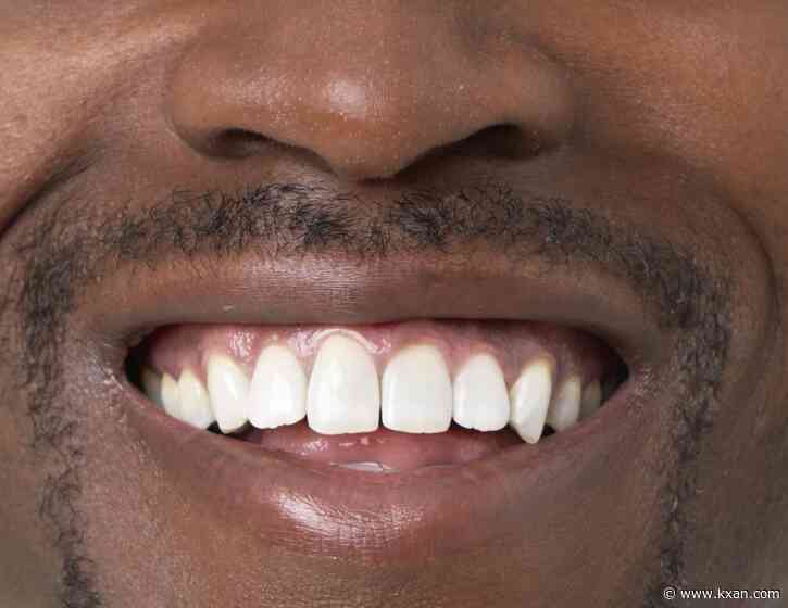 Human trials to begin for new teeth regeneration drug: researchers