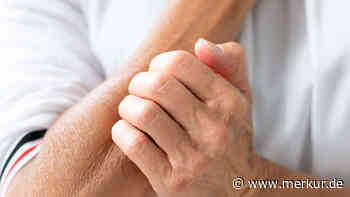 Hautkrebs frühzeitig erkennen: Achten Sie auf erste Anzeichen der Erkrankung