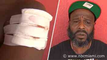 ‘Oh! You got shot!': 13-year-old, woman hit by stray bullets on Fourth of July in Miami-Dade