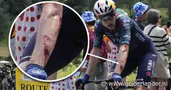 Wout van Aert denkt door te kunnen in Tour de France ondanks snijwond in zijn arm