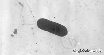 What is listeriosis? The illness behind the plant-based milk recall