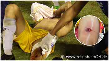 Brutalo-Vorfall im Amateurfußball: Polizei schießt Spieler mit Schrotflinte ins Bein