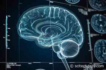 AI Outperforms: Stunning 82% Accuracy in Predicting Alzheimer’s Progression