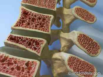 Long-Standing Puzzle Solved: Scientists Discover a New Hormone That Can Double Bone Mass