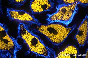 Macrophage Mayhem Unlocks Clues to Rare Neurodegenerative Condition