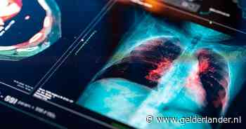 Kanker lijkt genezen, maar keert toch terug: arts over waarom ziekte dan vaak moeilijk te behandelen is