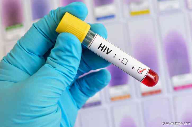 Austin Public Health talks accessibility for HIV treatment