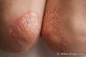 Air Pollution Exposure Tied to New Psoriasis