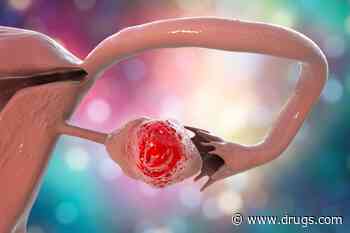 Risk for Ovarian Cancer Increased for Women With Endometriosis