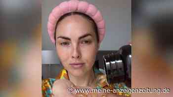 Vitamin E direkt ins Gesicht: Was ein Mediziner über den TikTok-Trend denkt