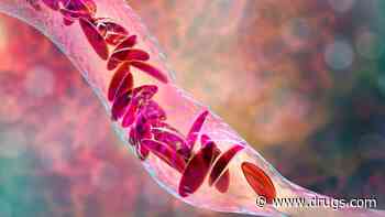 Common Sickle Cell Drug Won't Harm Female Fertility
