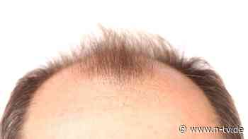 Zufällige Entdeckung: Zuckergel lässt Haare wieder kräftig wachsen