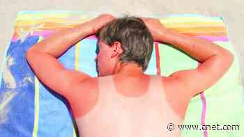 Can You Reverse Your Skin's Sun Damage? We Asked Experts