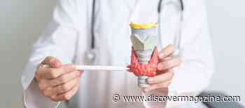 How Diet and Lifestyle Can Help Manage Graves’ Disease