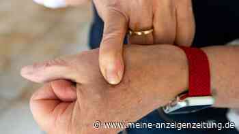 Umfrage: Mehr als ein Drittel ist offen für Chip-Implantate