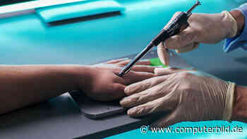 So viele Deutsche sind offen für ein Chip-Implantat