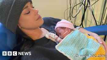 'Our daughter weighed less than a bag of sugar'