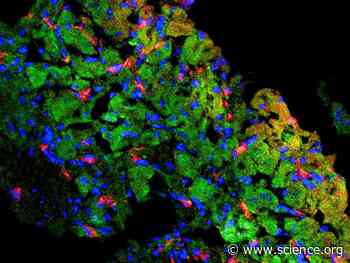 Peripheral macrophages contribute to nociceptor priming in mice with chronic intermittent hypoxia | Science Signaling