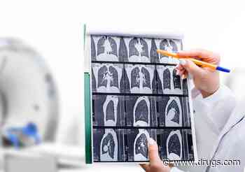 Most Americans Don't Know About Lung Cancer Screening: Survey