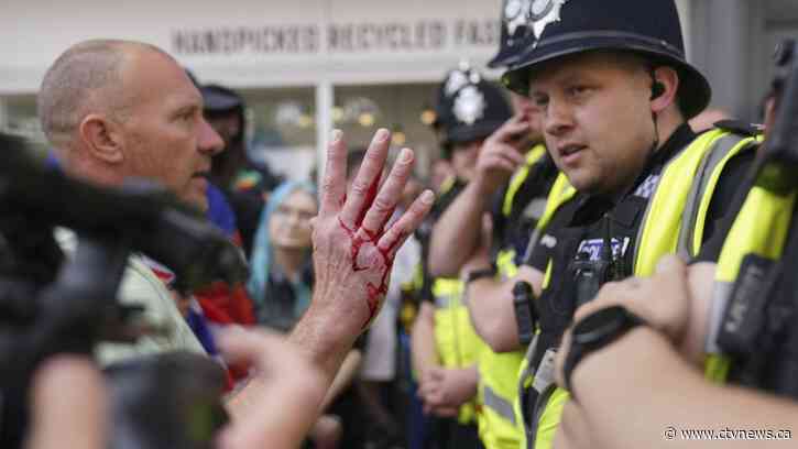 Police officers injured as far-right activists face off against anti-racism groups across U.K.