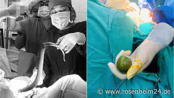 Mann steckt sich lebenden Aal und Limette in den Po – nur eine Not-OP rettet ihm das Leben