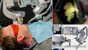The robo-dentist will see you now: AI bot operates on a live human without supervision for the first time - and it's 8 times faster than a normal specialist