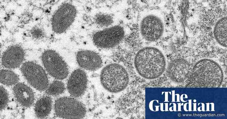 Mpox outbreak puts Africa on brink of official public health emergency